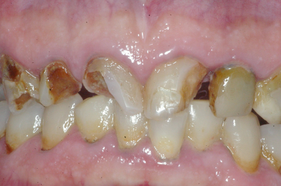 Hathorne Family Dental