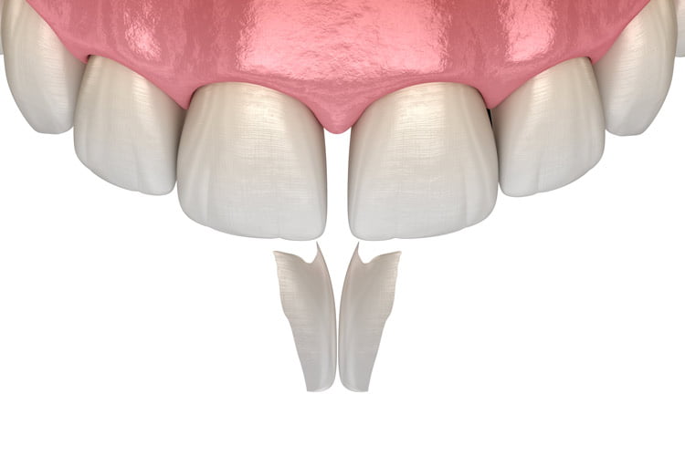 Hathorne Family Dental Hathorne Family Dental