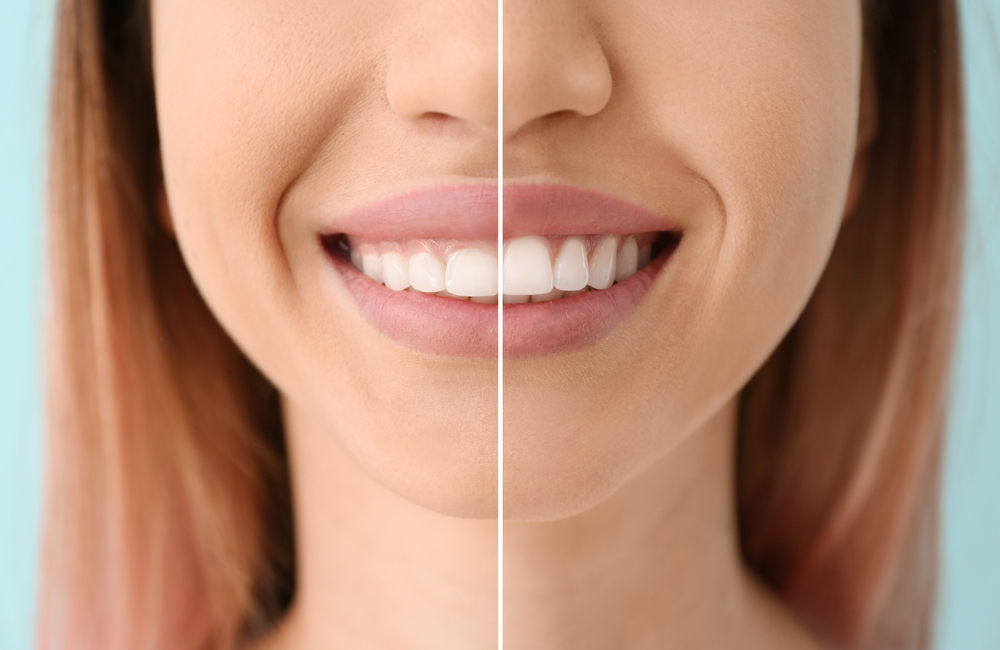 Hathorne Family Dental Hathorne Family Dental