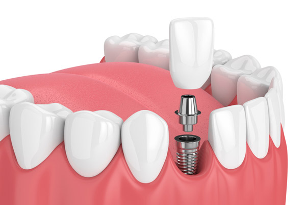 Hathorne Family Dental Hathorne Family Dental