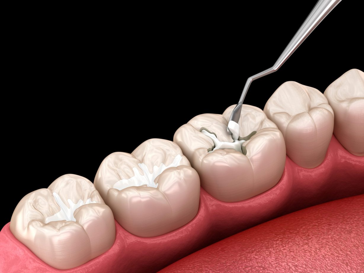 Hathorne Family Dental Hathorne Family Dental