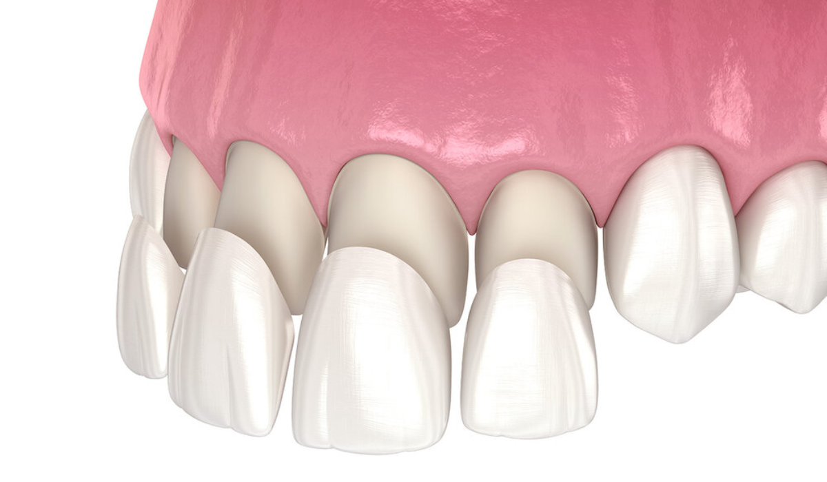 Hathorne Family Dental Hathorne Family Dental