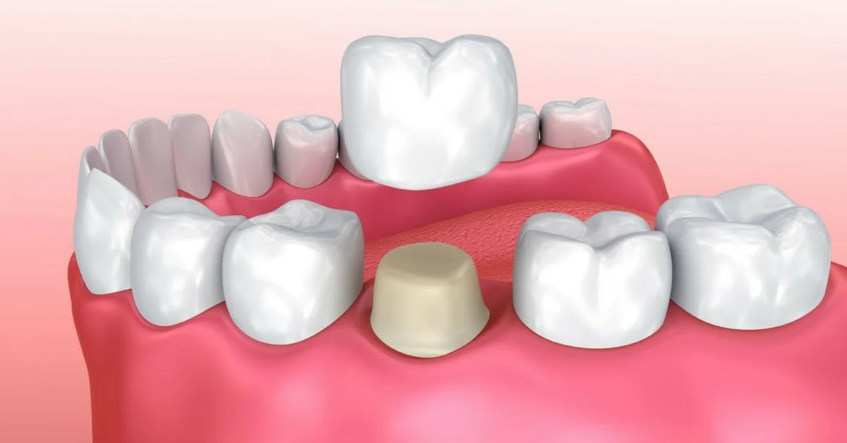 Hathorne Family Dental Hathorne Family Dental