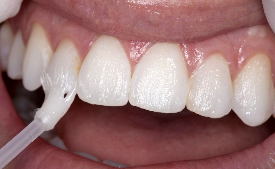 Hathorne Family Dental Hathorne Family Dental
