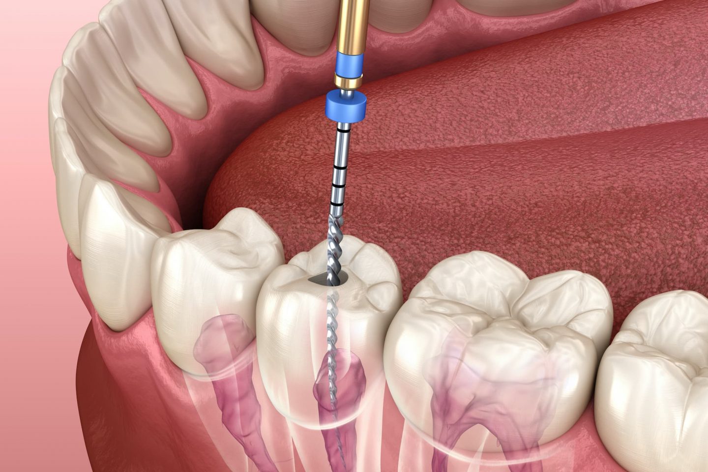 Hathorne Family Dental Hathorne Family Dental