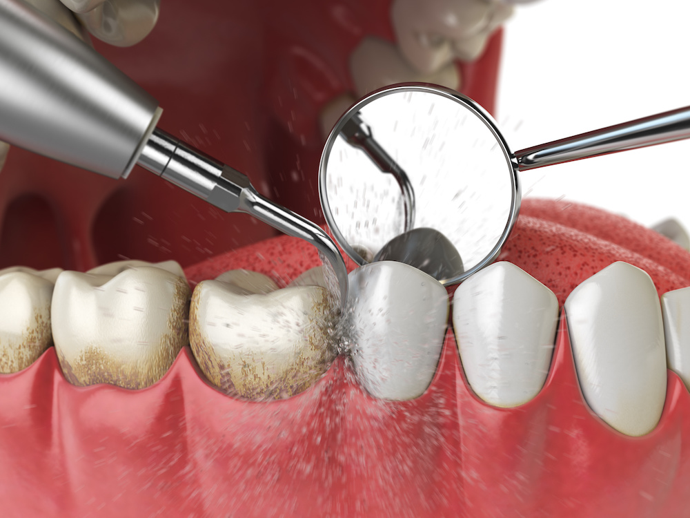 Hathorne Family Dental Hathorne Family Dental