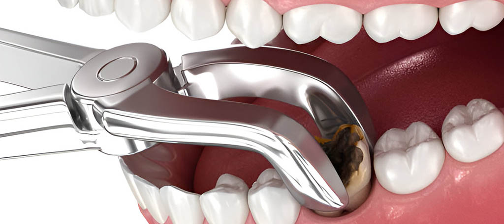 Hathorne Family Dental Hathorne Family Dental
